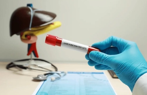 liver-function-test